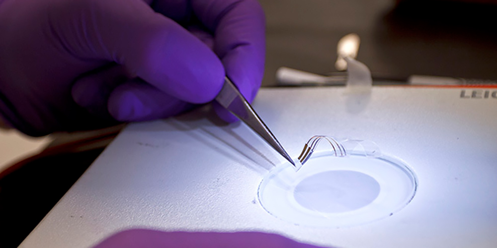 A gloved hand using tweezers to manipulate an implantable device